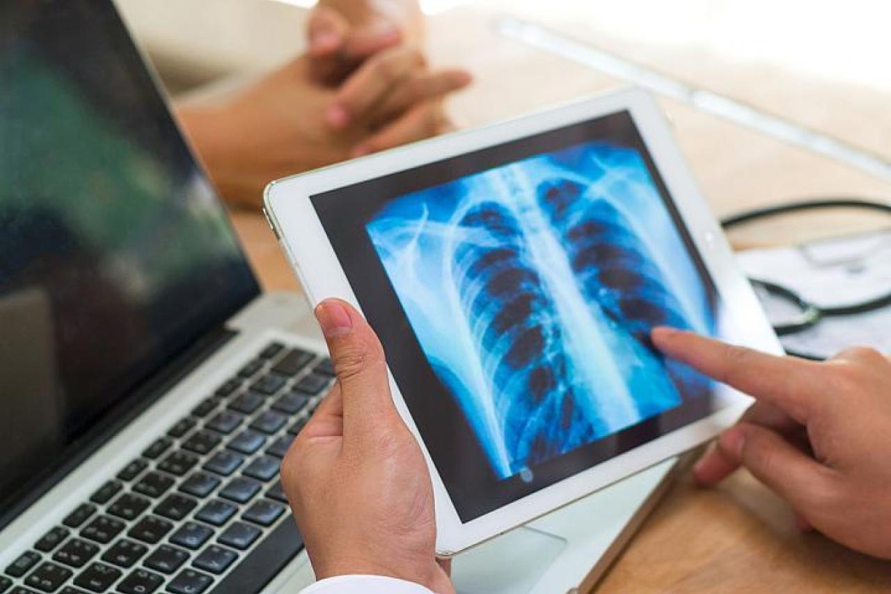 Health care provider looking at a lung X-ray in their office with a patient.