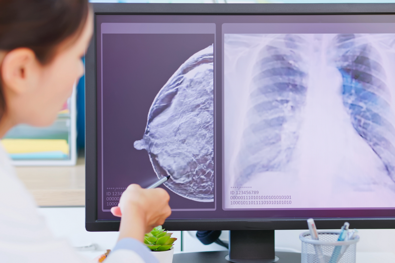 woman doctor showing mammography test results and X-ray on a computer to a patient