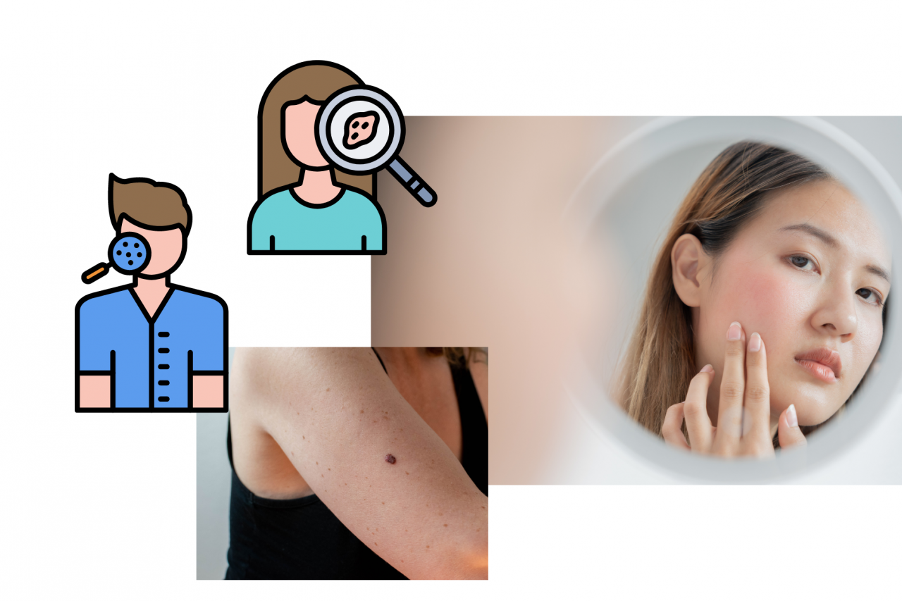 Vector art of a man and woman getting a skin checkup; a woman looking at her face in the mirror; closeup of a person’s arm that has a mole