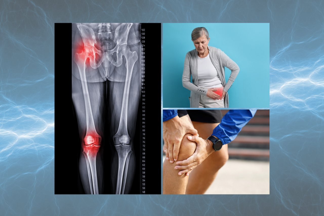 Managing Arthritis Without Over-Reliance on Medication
