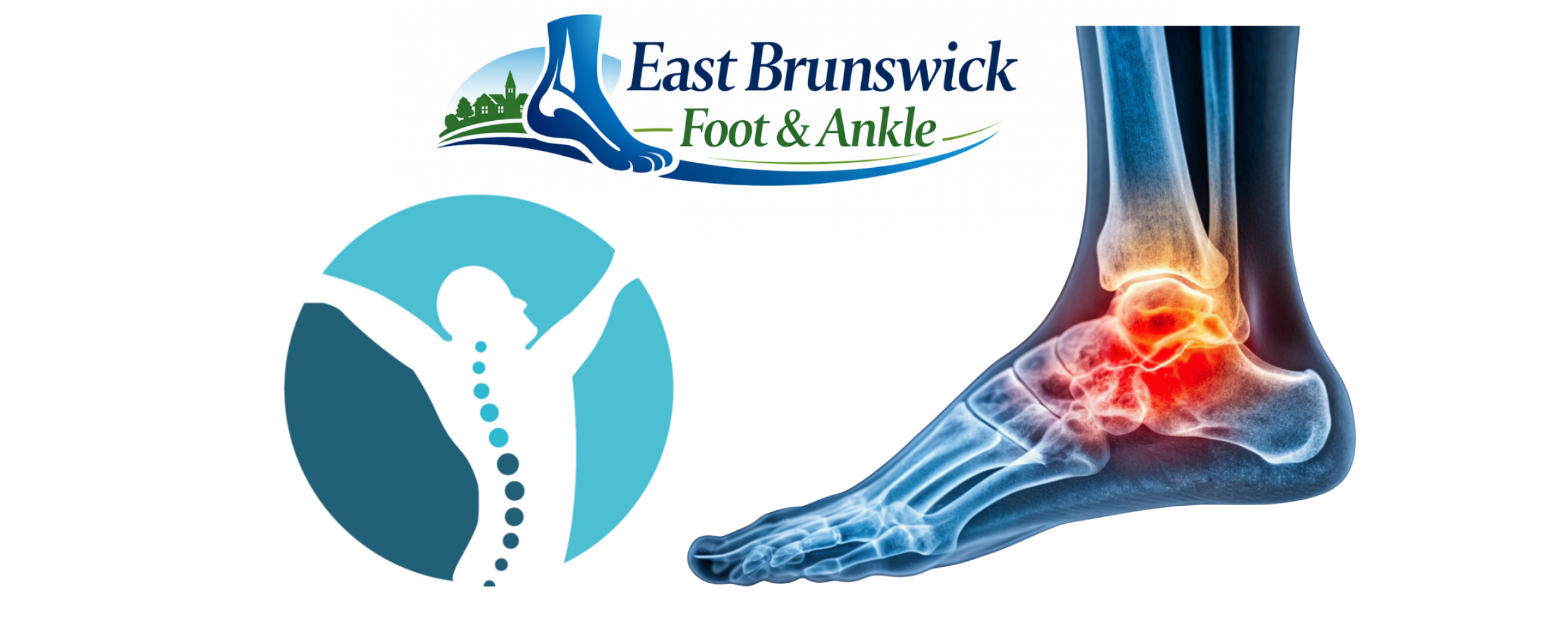 Illustration of ankle pain x-ray with logos for East Brunswick Foot & Ankle and Spineck Physical Therapy