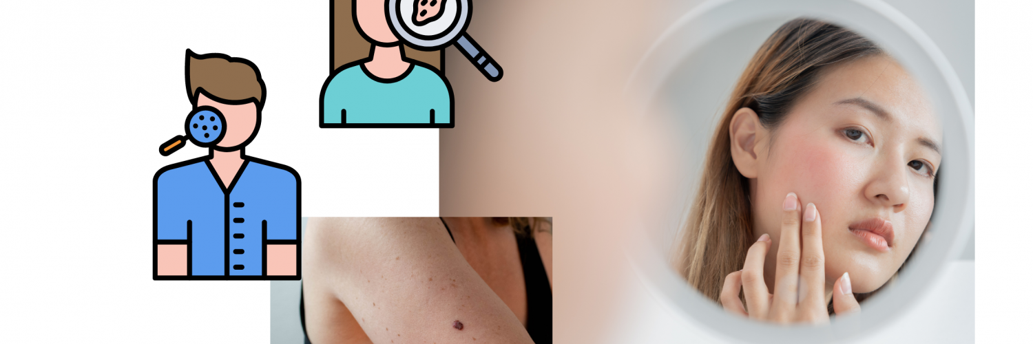 Vector art of a man and woman getting a skin checkup; a woman looking at her face in the mirror; closeup of a person’s arm that has a mole