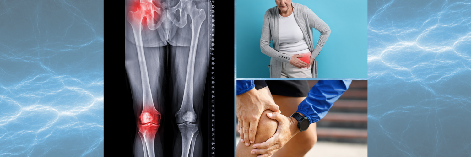 Managing Arthritis Without Over-Reliance on Medication